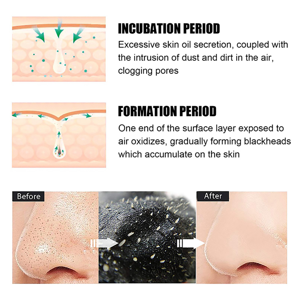 10-100 Unidades Máscara Remove - Nasal Aspirator avaliação e preço